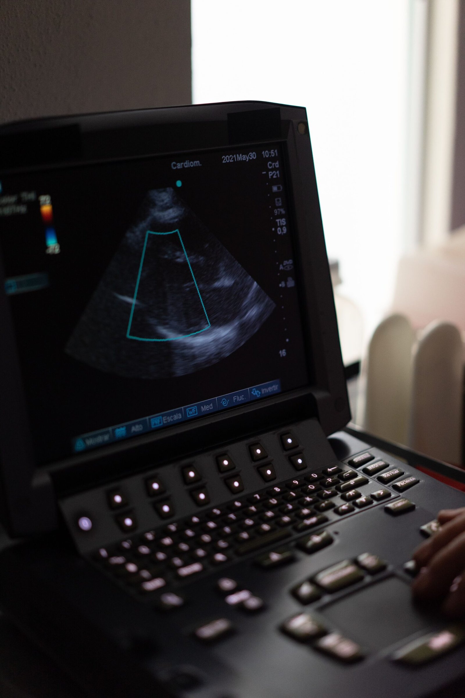 Mid-trimester 3D 4D pregnancy ultrasound scan showing clear fetal facial features and movement.