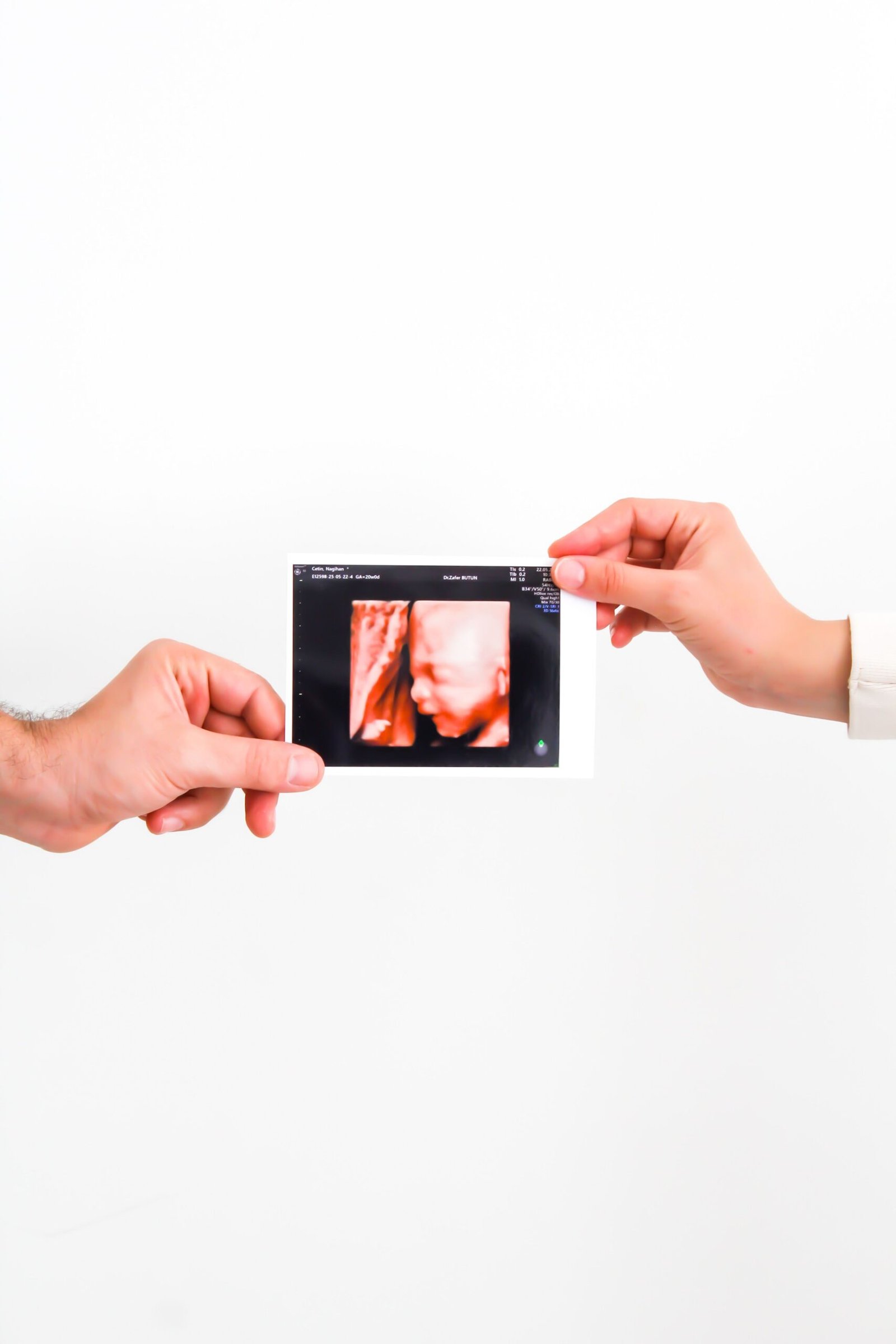 Two-visit 3D 4D ultrasound growth package comparing early fetal movement to late trimester chubby cheeks.