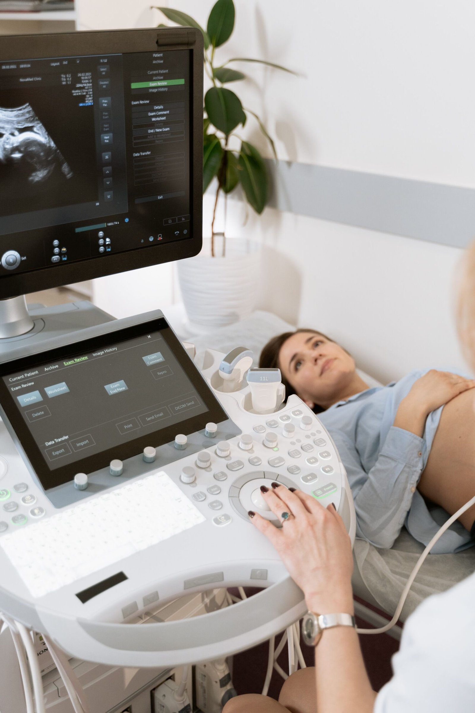 Early pregnancy heartbeat ultrasound scan showing live fetal cardiac activity monitor display.