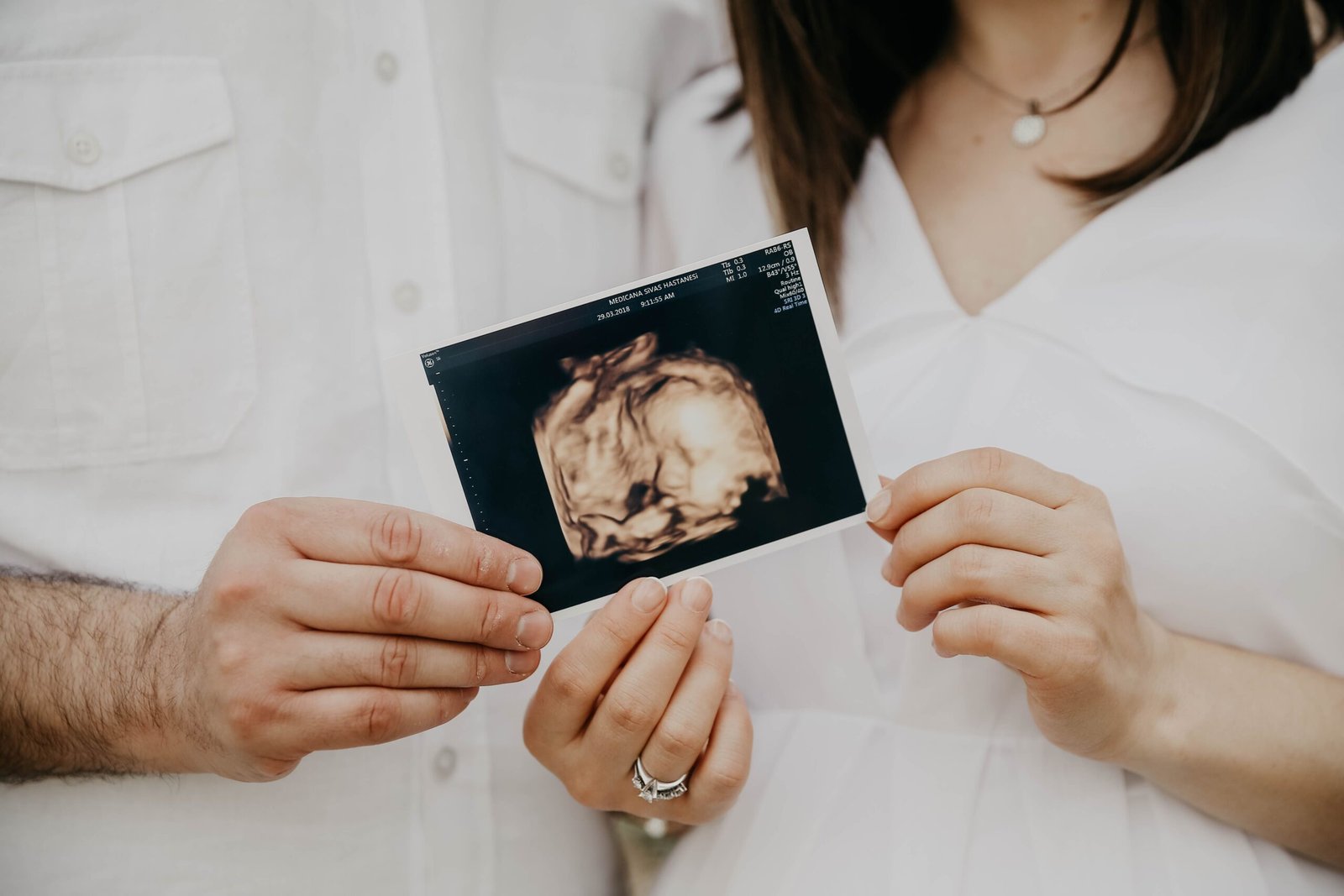 Premium early pregnancy 2D ultrasound confirmation scan display showing early embryonic heartbeat.