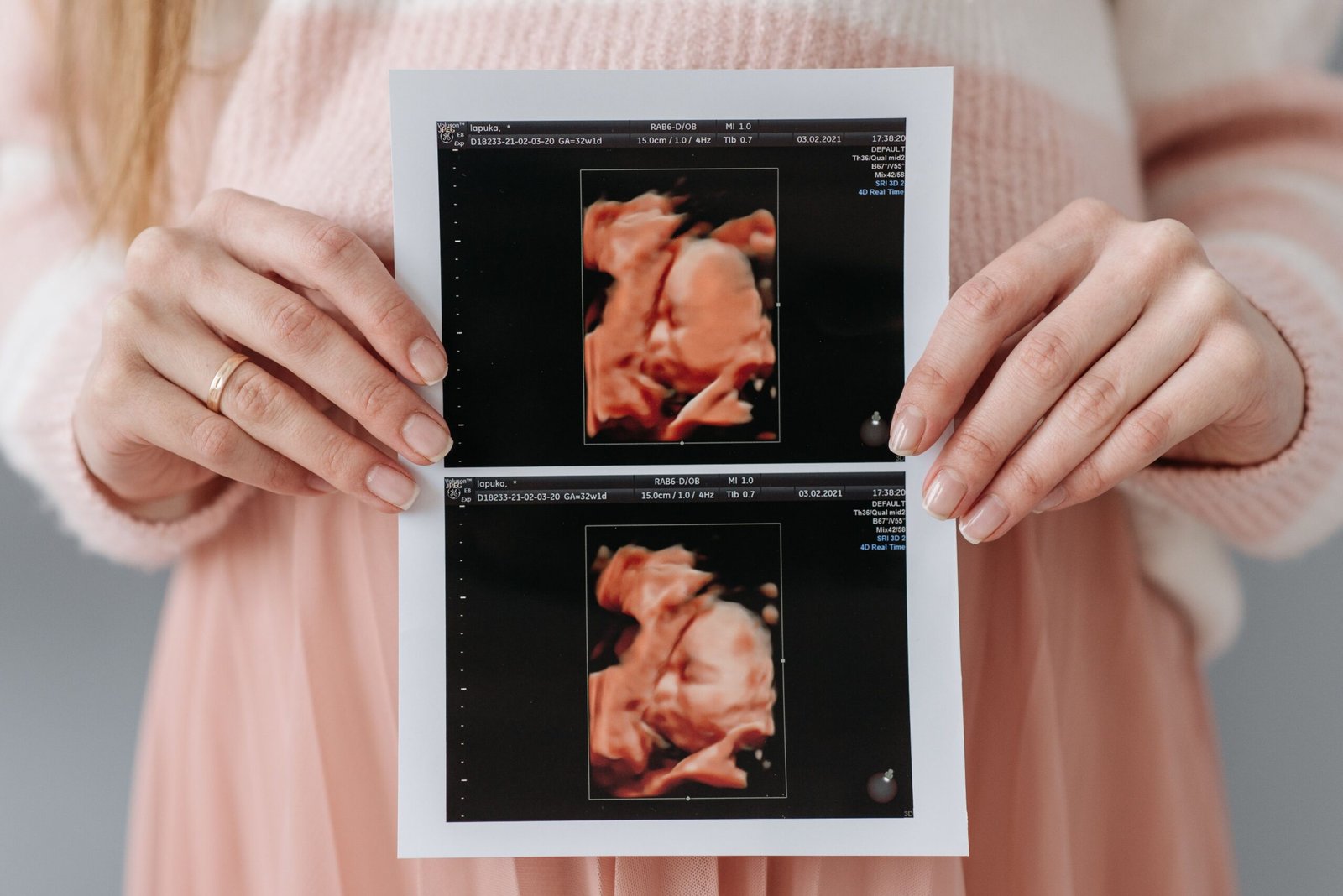 Late trimester baby position ultrasound scan confirming fetal placement before delivery.