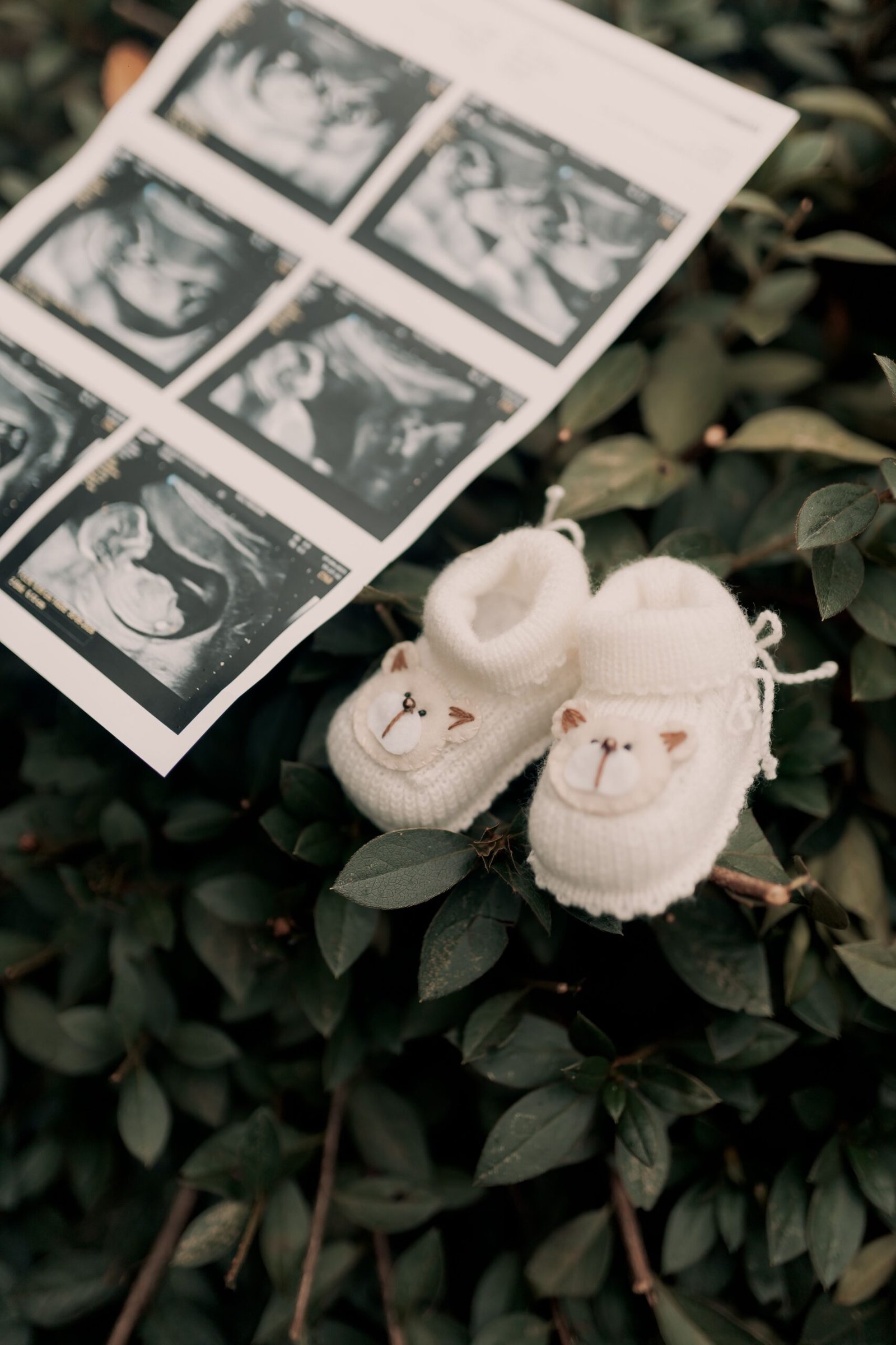 Early 14 week gender reveal ultrasound scan image displaying accurate gender determination.